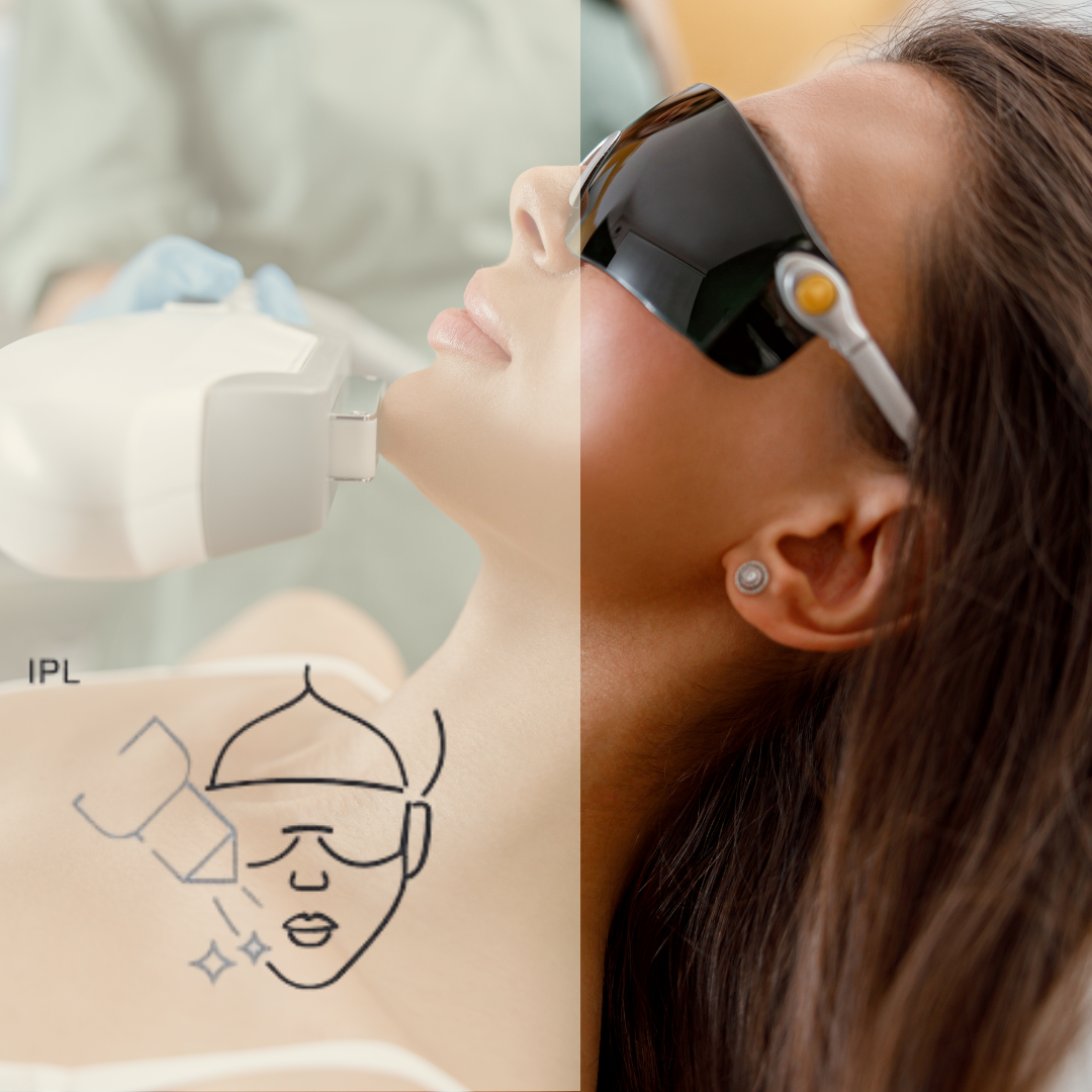 eLos IPL+RF Skin Rejuvenation